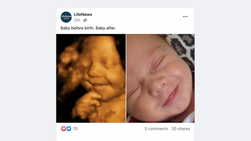 Viser dette billede foster, der smiler i mors mave?